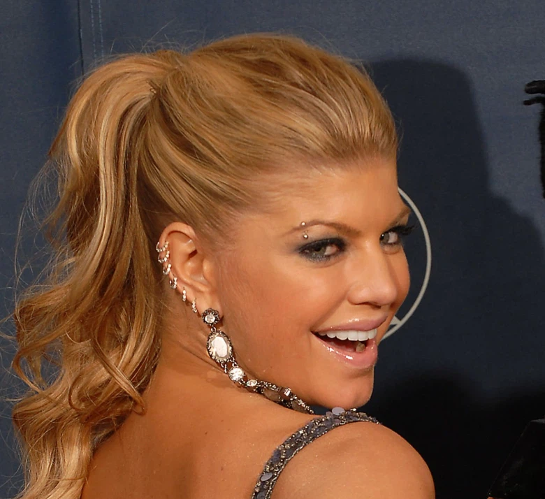 fergie dents en 2007