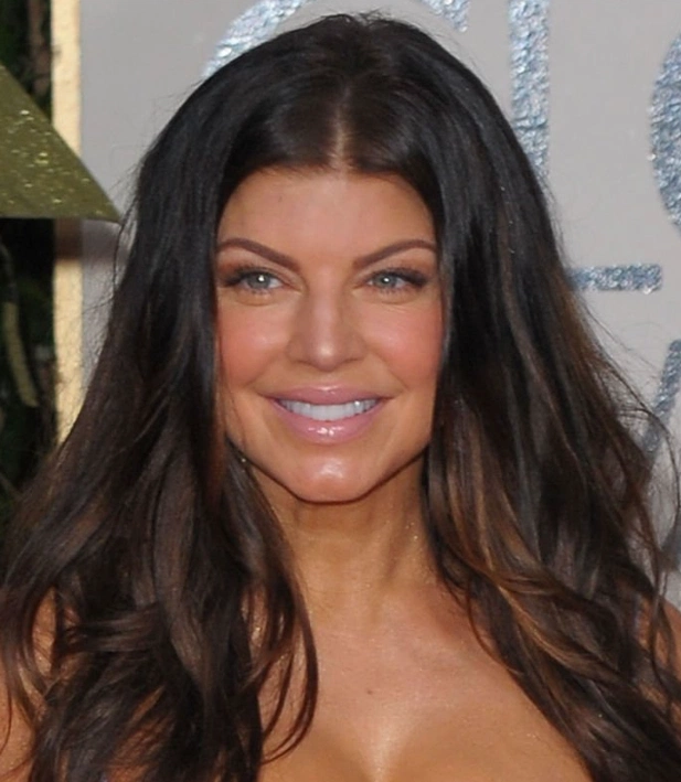 fergie dents en 2010