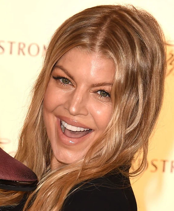 fergie dents en 2015