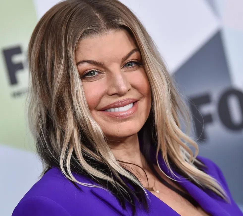 fergie dents en 2020