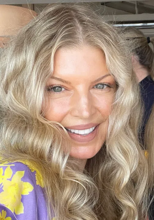 fergie dents en 2025
