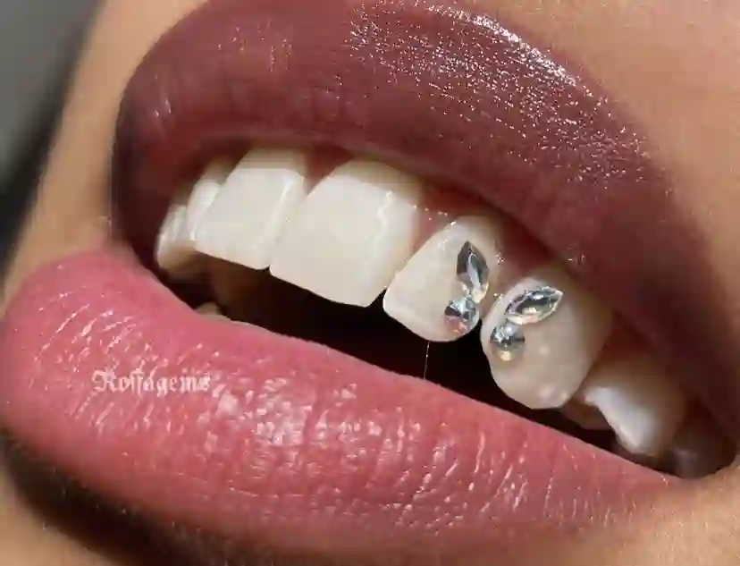 grillz