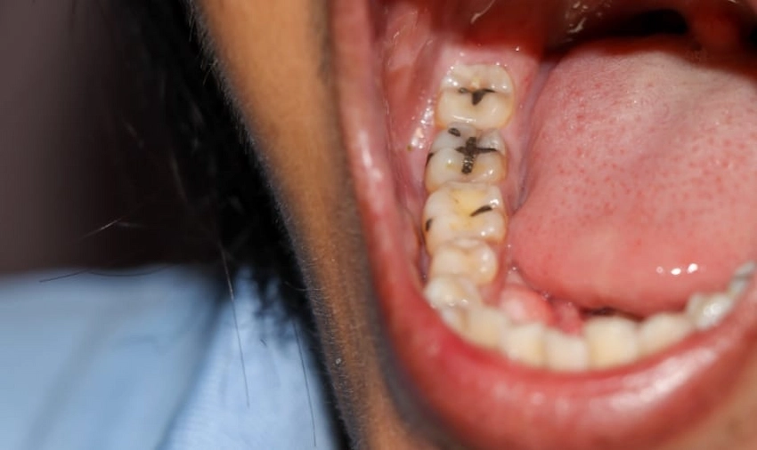 how can i keep my teeth healthy
