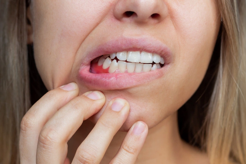 how is periodontitis treated