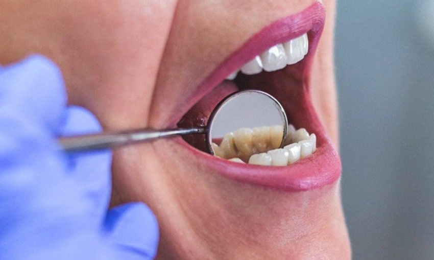 how is tooth root infection treated