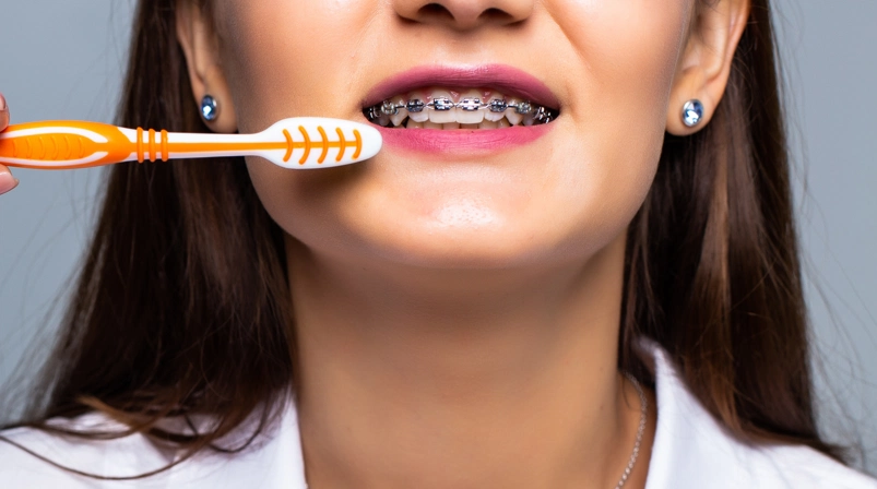 how to clean teeth with braces (3)