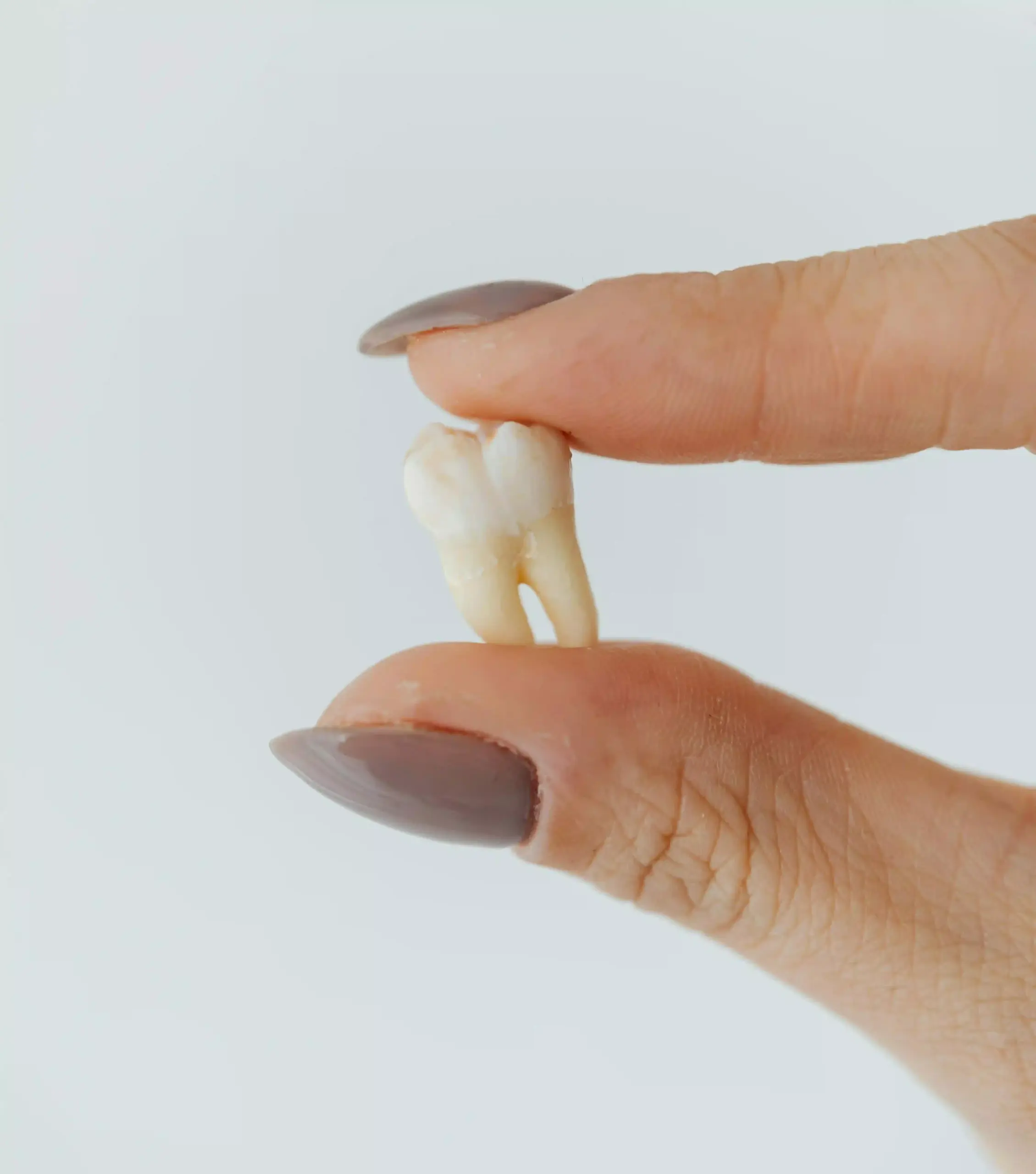 impacted wisdom teeth