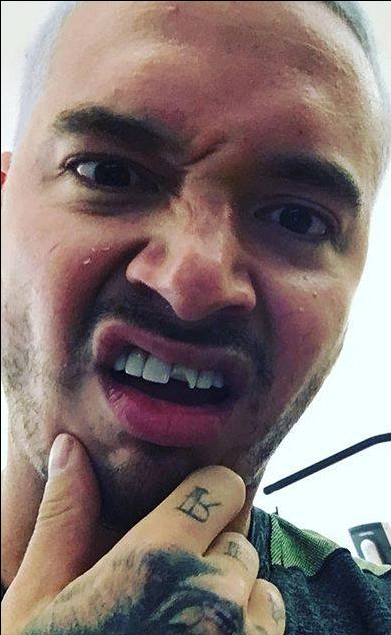 j balvin teeth in 2016