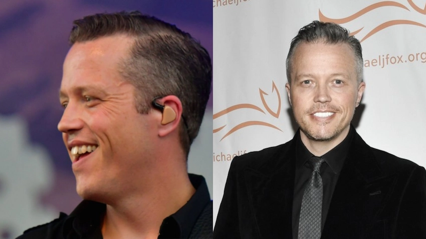jason isbell teeth before after