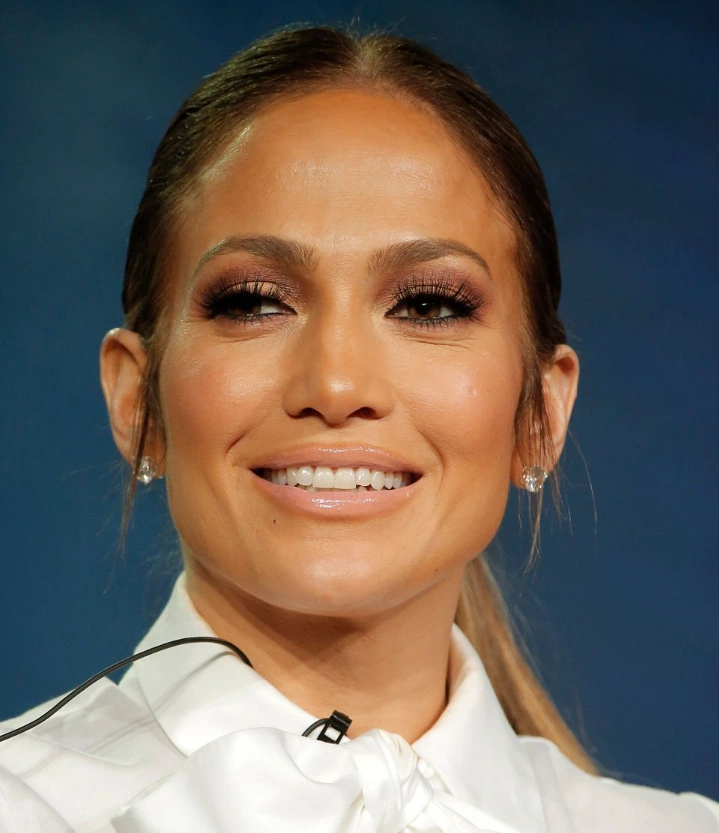 dientes de jennifer lopez en 2017