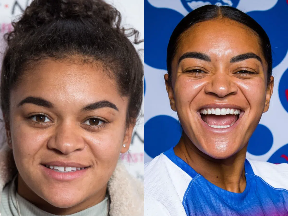 jess carter teeth before after