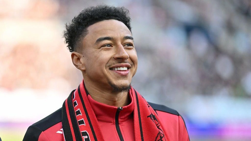 jesse lingard teeth before after
