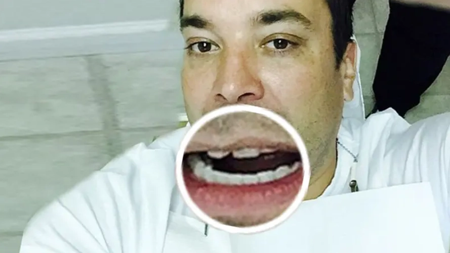 jimmy fallon teeth cover