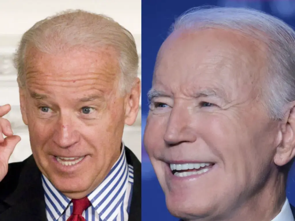 dientes de joe biden antes y después