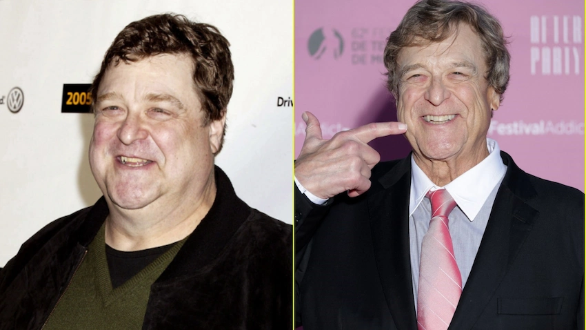 john goodman teeth before after