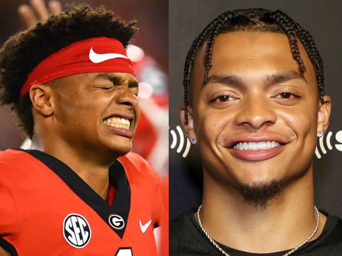 justin fields teeth before after