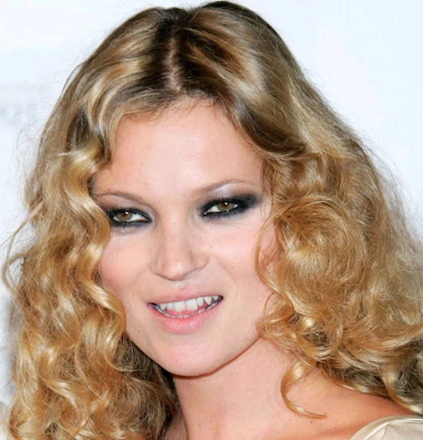 dinții kate moss 2005
