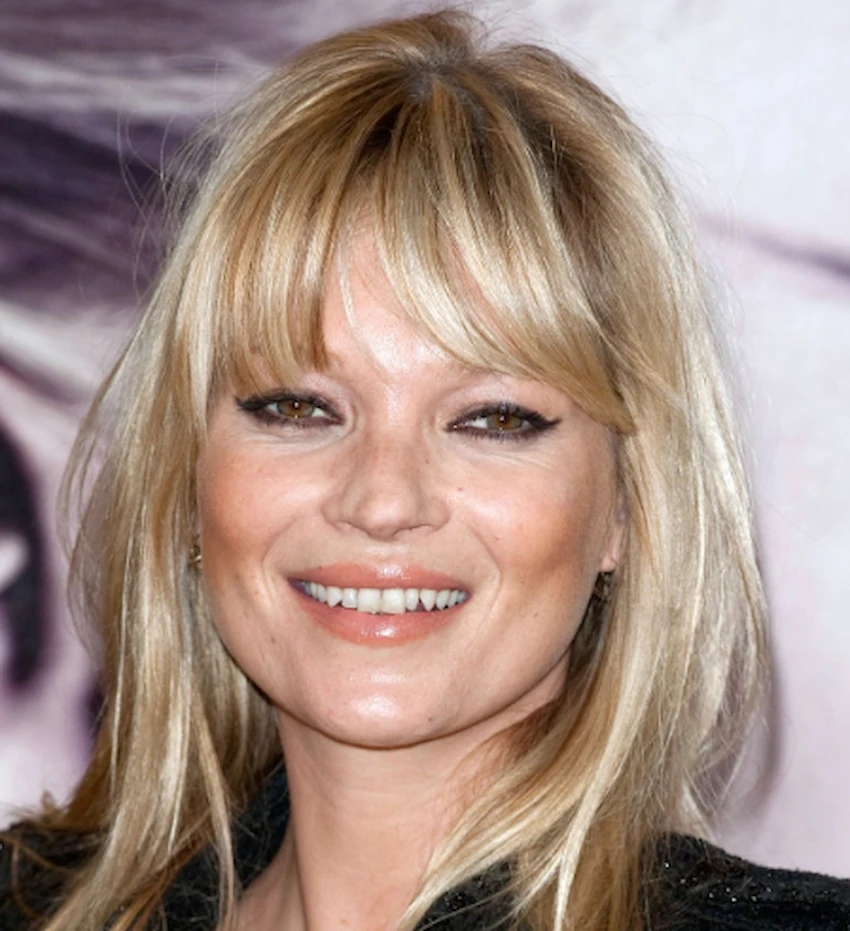 dinții kate moss 2010