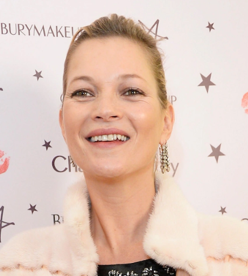 dinții kate moss 2015
