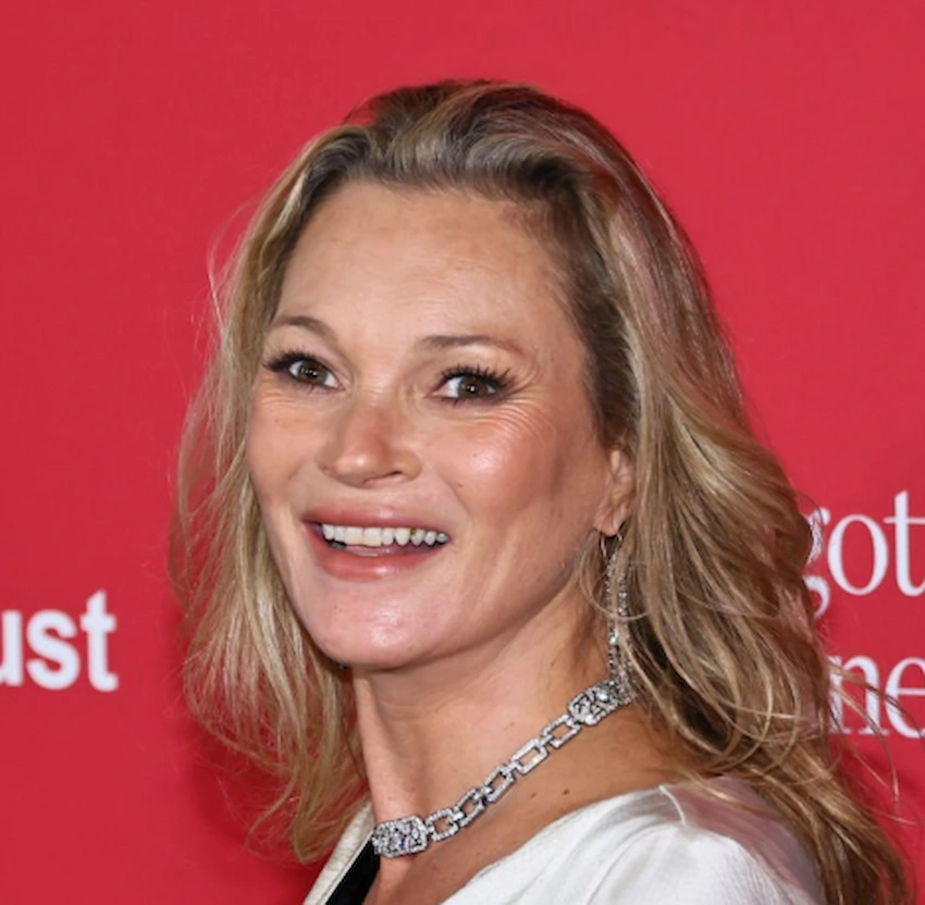 dinții kate moss 2025