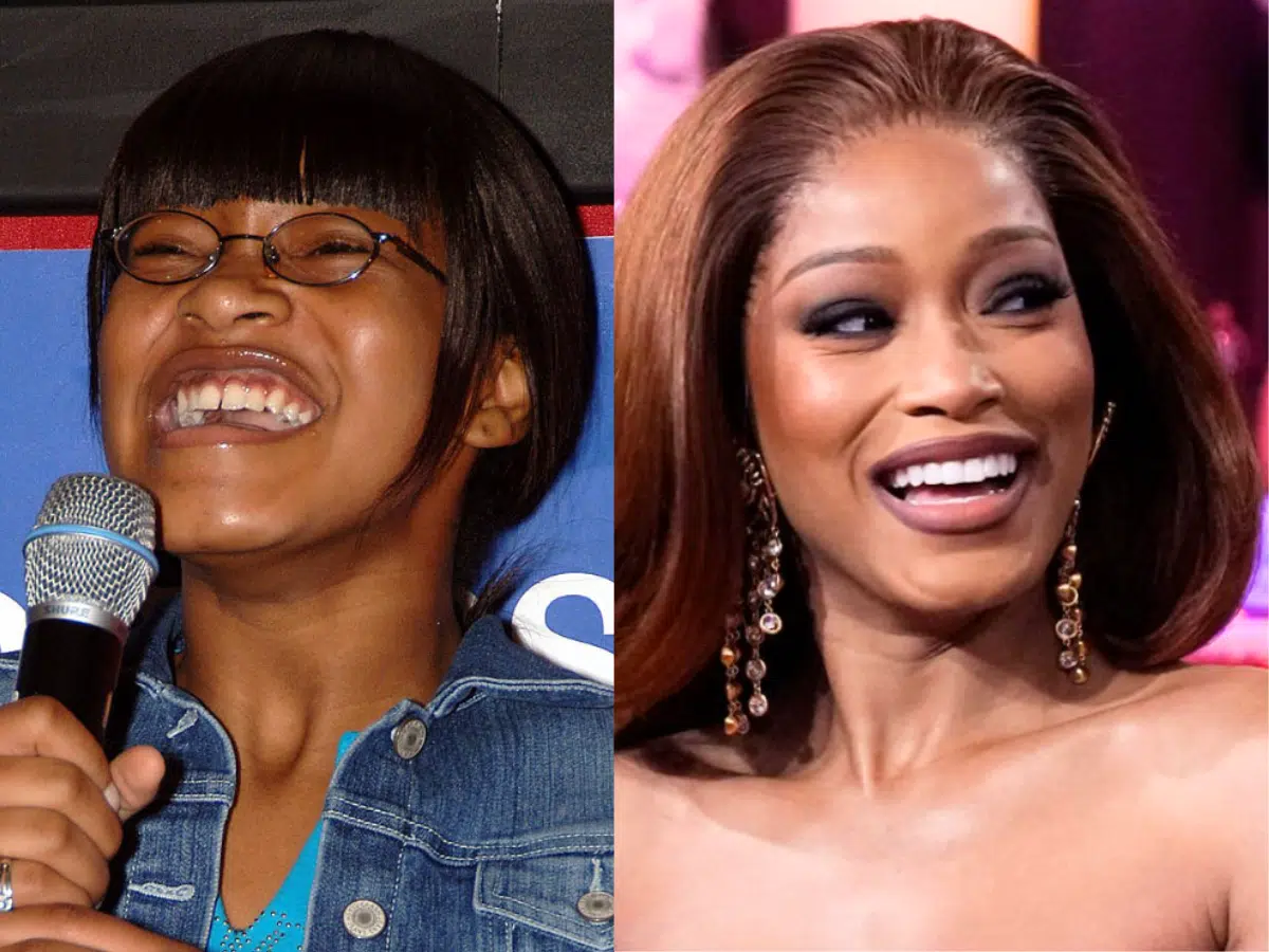 keke palmer teeth before after