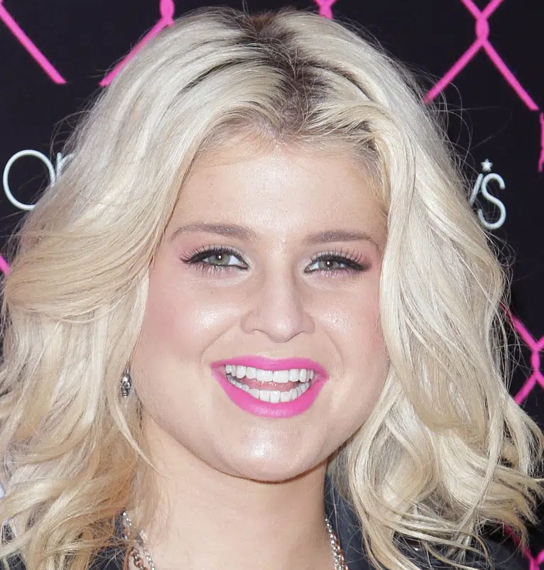 dinții lui kelly osbourne în 2011