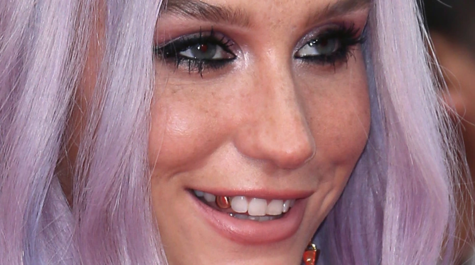 kesha cover pic