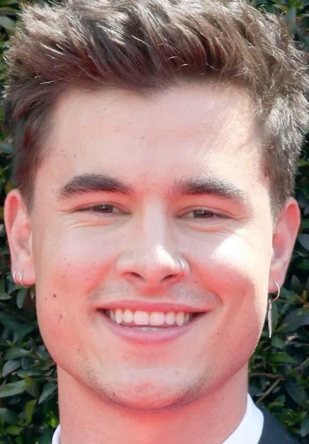 dientes de kian lawley en 2016