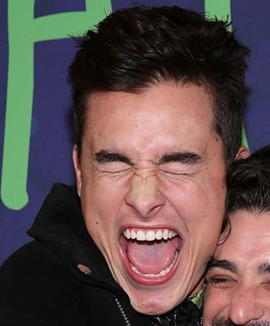 dientes de kian lawley en 2017