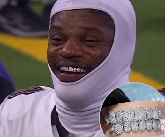 dents de lamar jackson en 2025