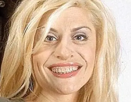 dientes de loredana groza en 2003