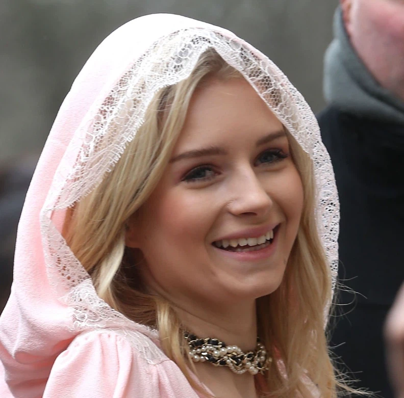 lottie moss teeth in 2017