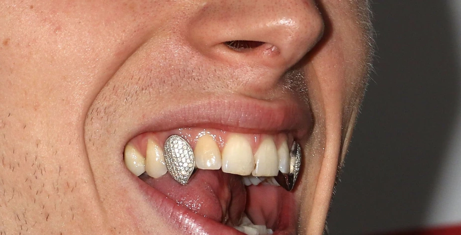 machine gun kelly silver teeth