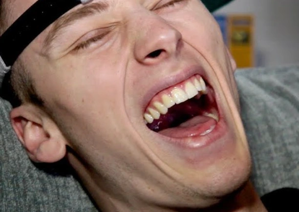 machine gun kelly teeth in 2010