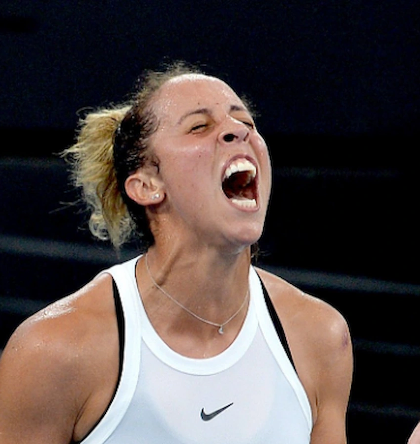 madison keys denti 2020