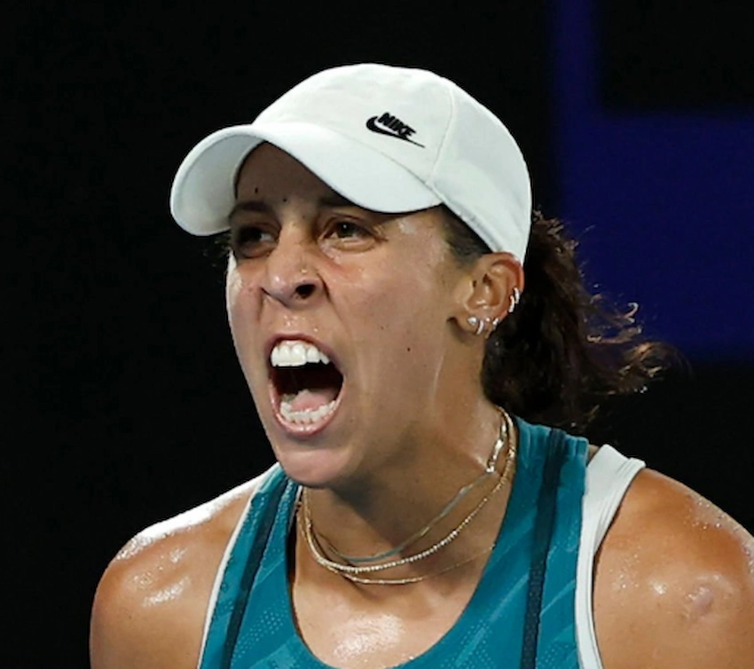 madison keys denti 2025