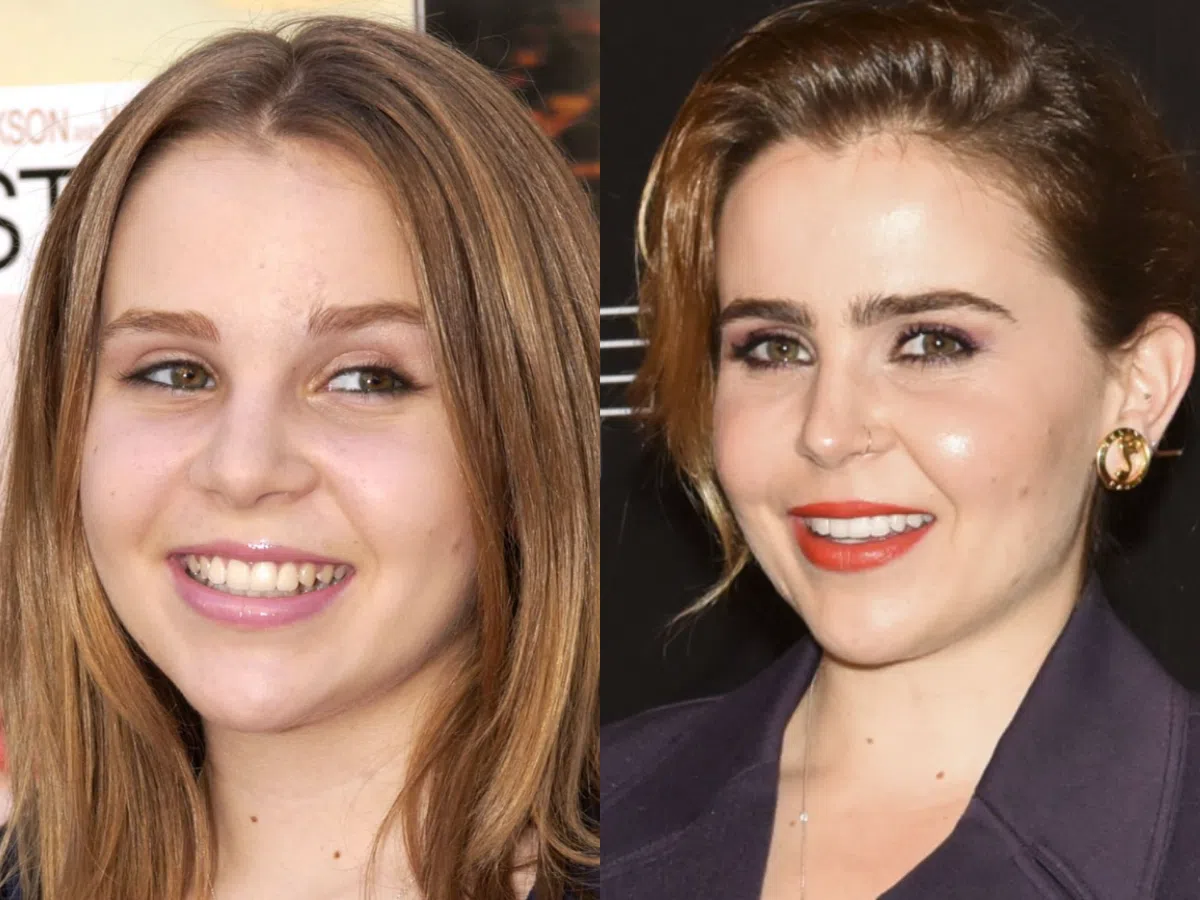 mae whitman teeth before after