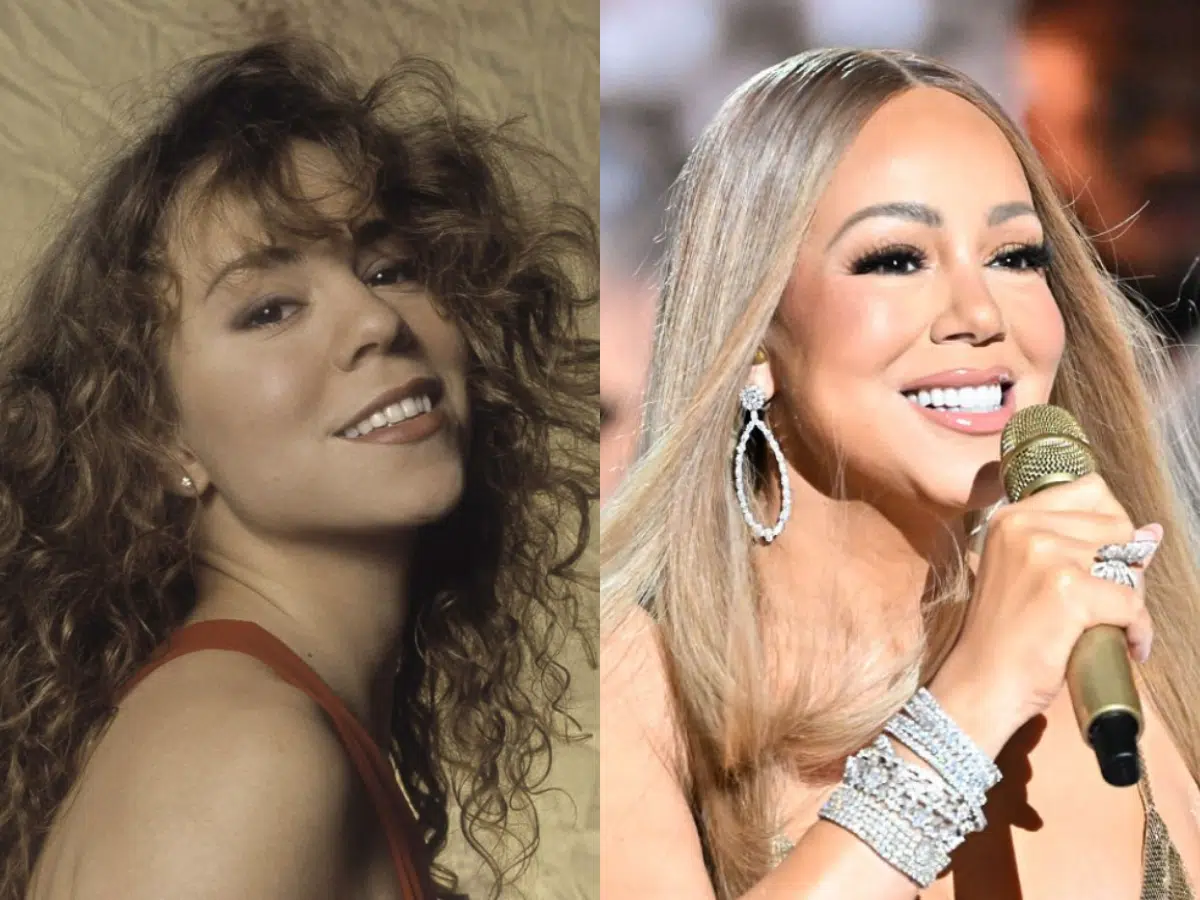 mariah carey teeth before after