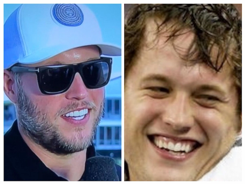 matthew starfford teeth before after