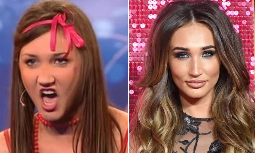 megan mckenna teeth