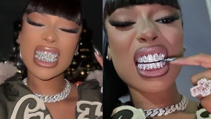megant thee stallion teeth