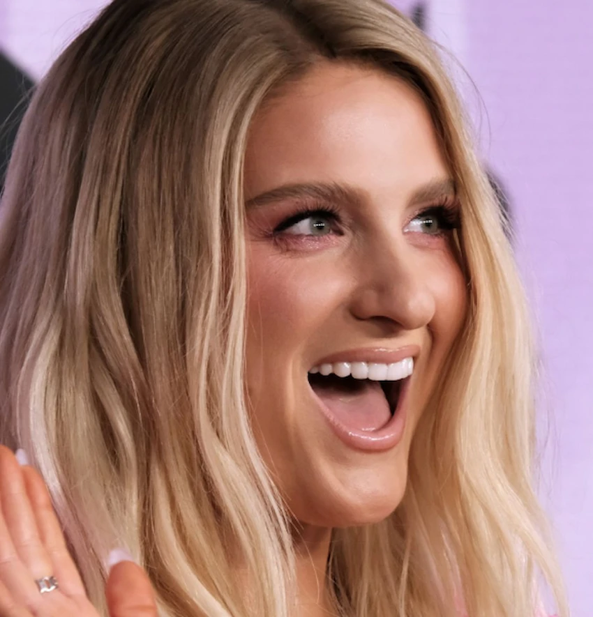 meghan trainor teeth 2022