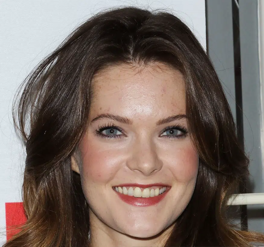 meghann fahy teeth in 2015