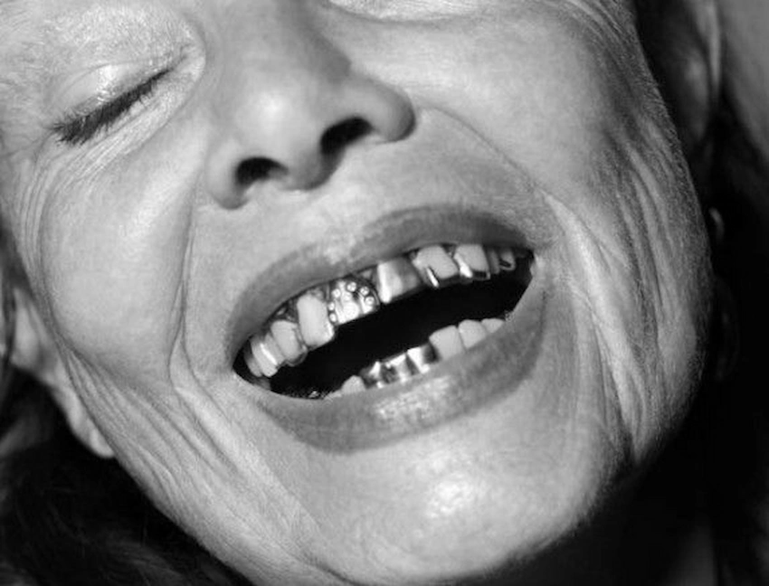 michele lamy teeth