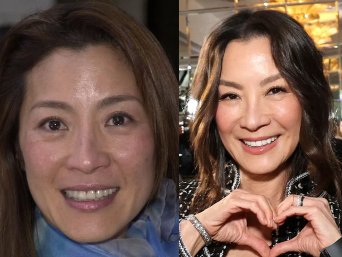 michelle yeoh teeth before after