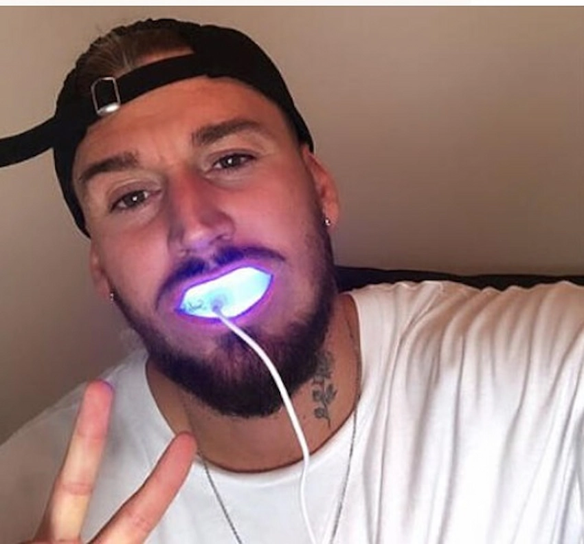 mike heiter teeth