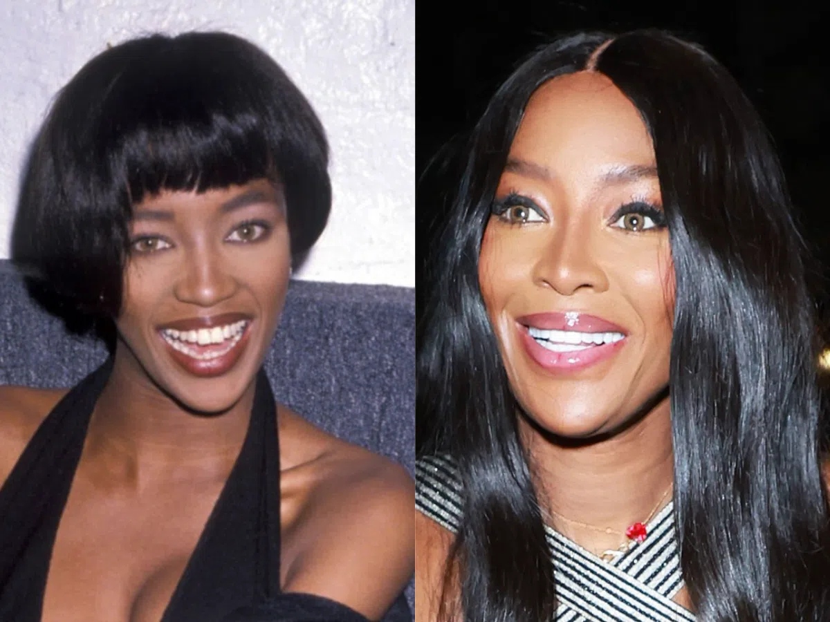 naomi campbell teeth before after