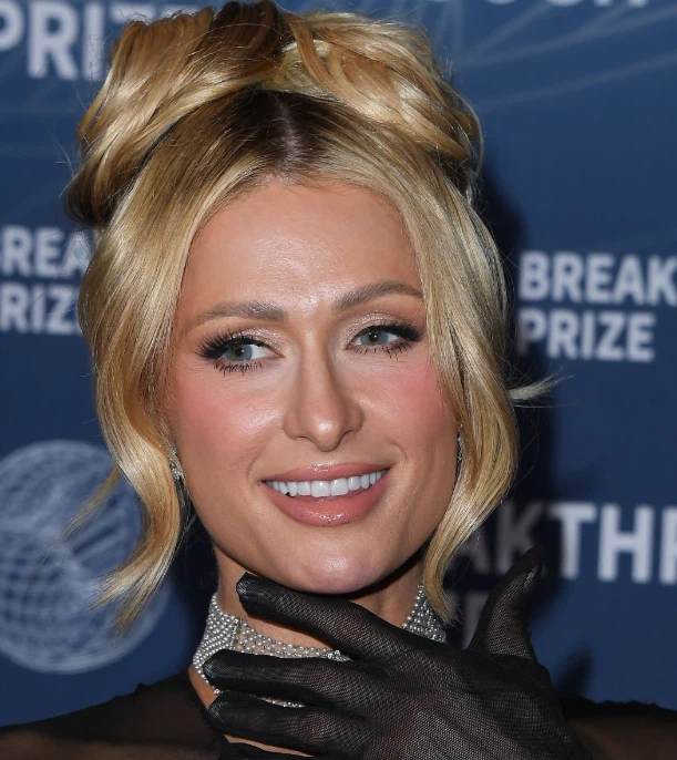 paris hilton teeth in 2025