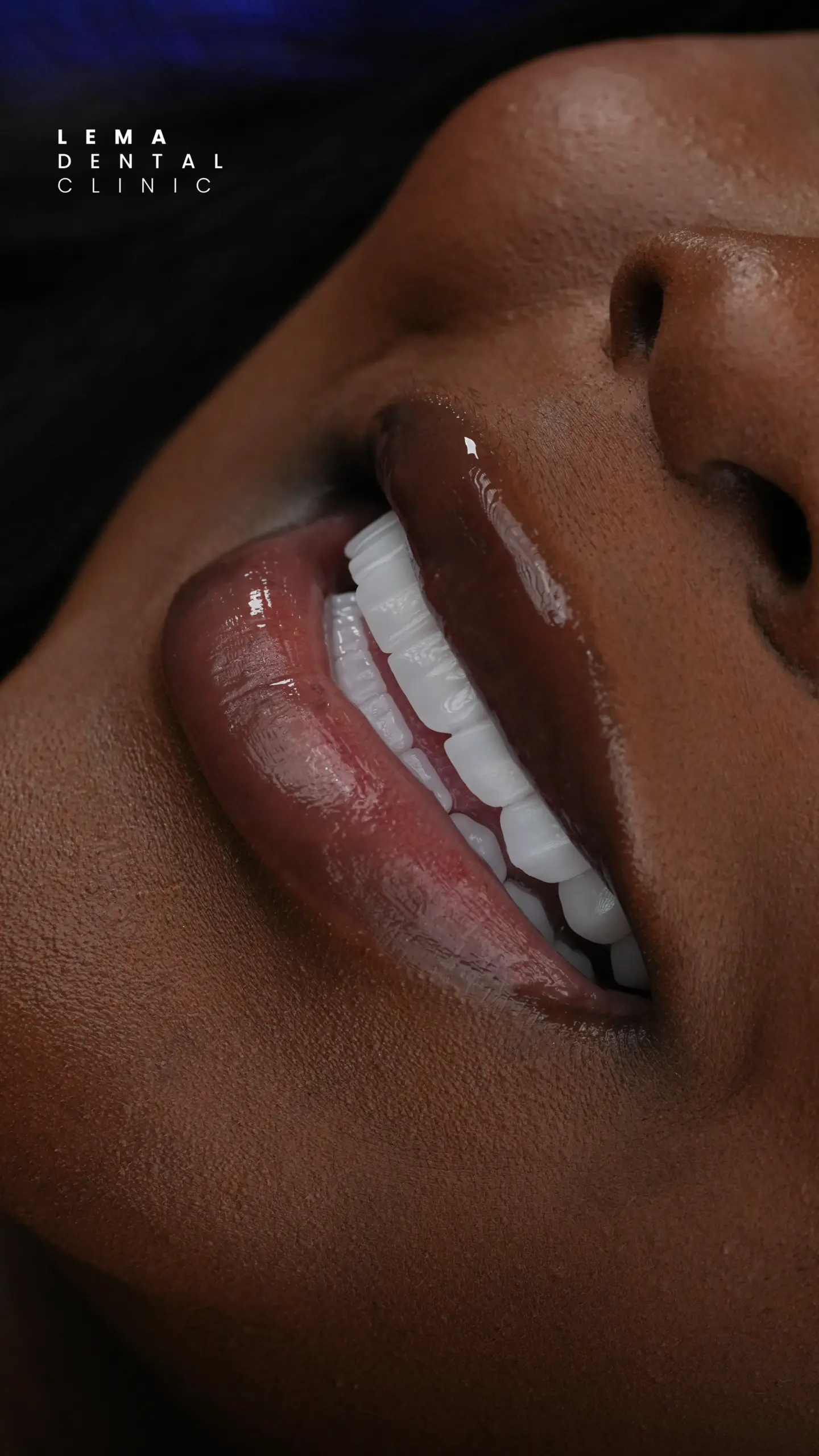 Hollywood Smile 3