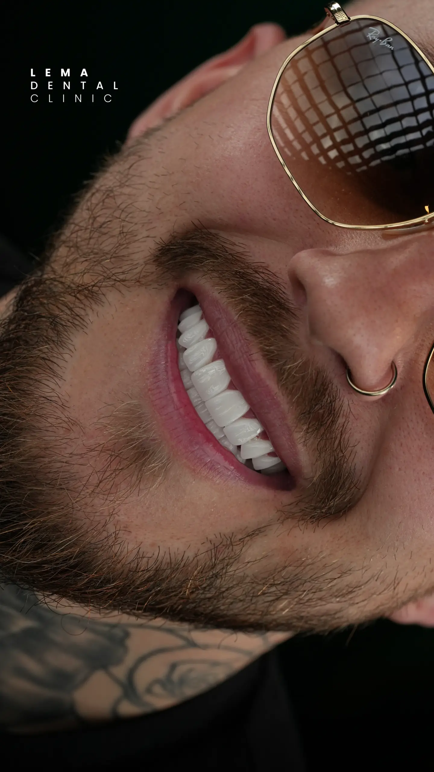 Hollywood Smile 2